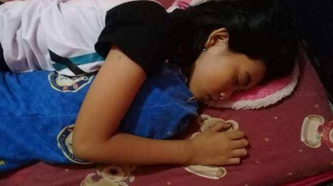 Putri Tidur Banjarmasin Kembali Terlelap, Sempat Viral Tertidur 13 hari