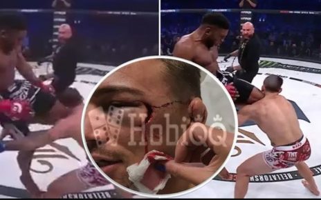 Pertarungan Keras! 5 Petarung MMA yang Cedera Fatal dalam Pertandingan