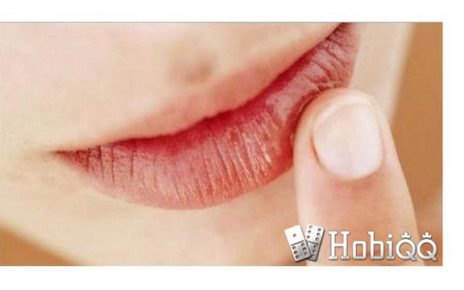 3 Cara Menghilangkan Cracked Lips dengan Bahan Alami