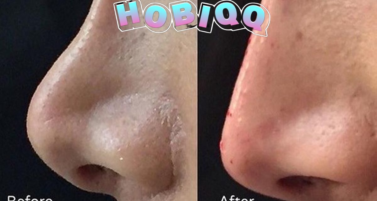 Kelebihan Orang yang Punya Hidung Pesek